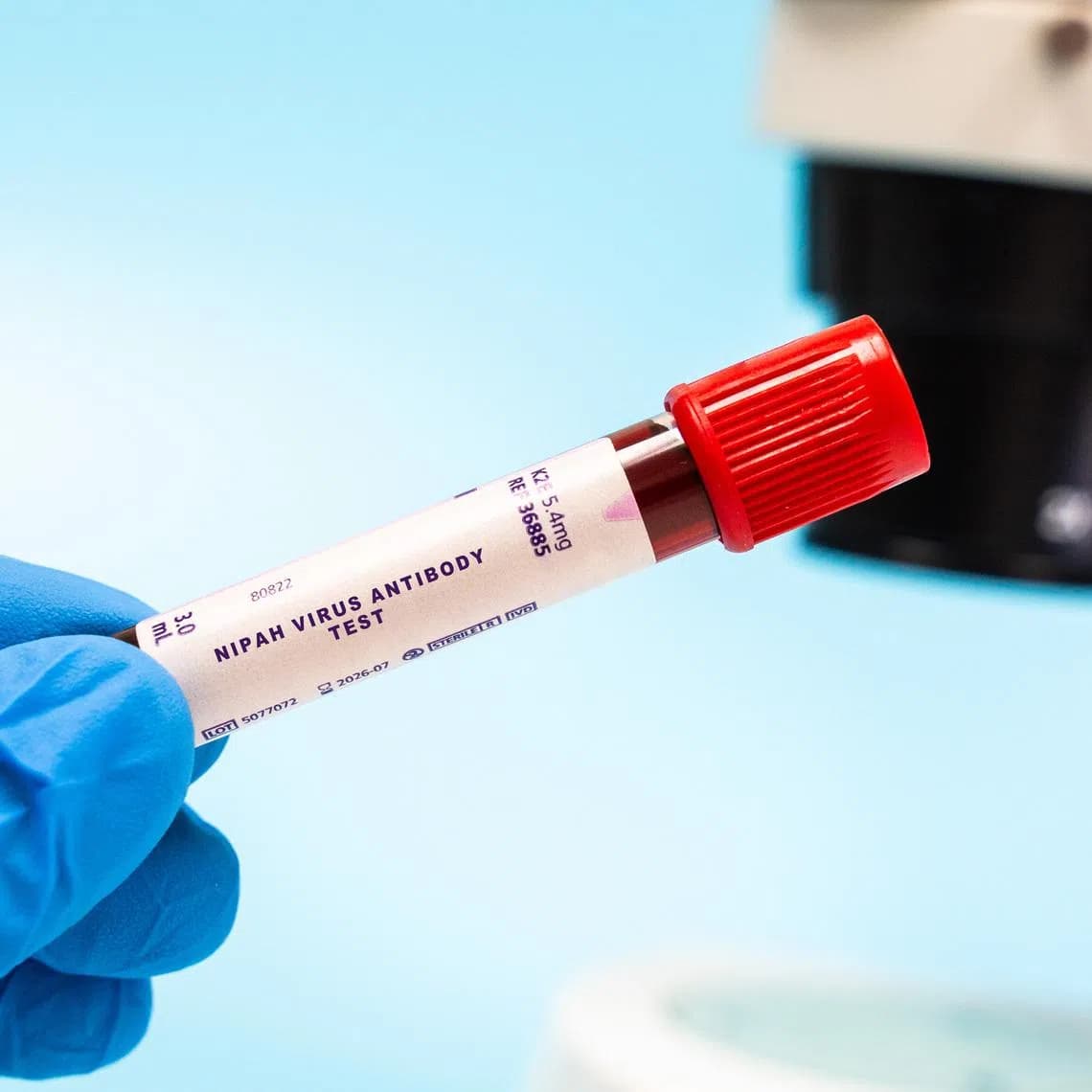 Nipah virus antibody test. Identifying antibodies to the Nipah virus indicating exposure to the virus, and specifically, the type of antibody (IgM or IgG) provides clues about the timing of exposure. (AFP)