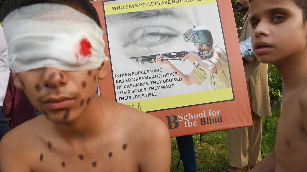 Pellet guns violence in Indian occupied Kashmir
