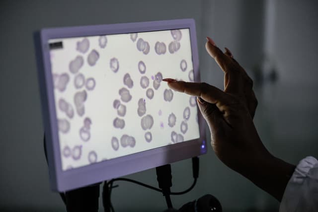 Medical technologist and laboratory manager at the National Health Laboratory Service Rirhandzu Mashale points to a malaria-positive blood sample projected from a microscope at Tintswalo Hospital in Bushbuckridge on May 26, 2026. (AFP)