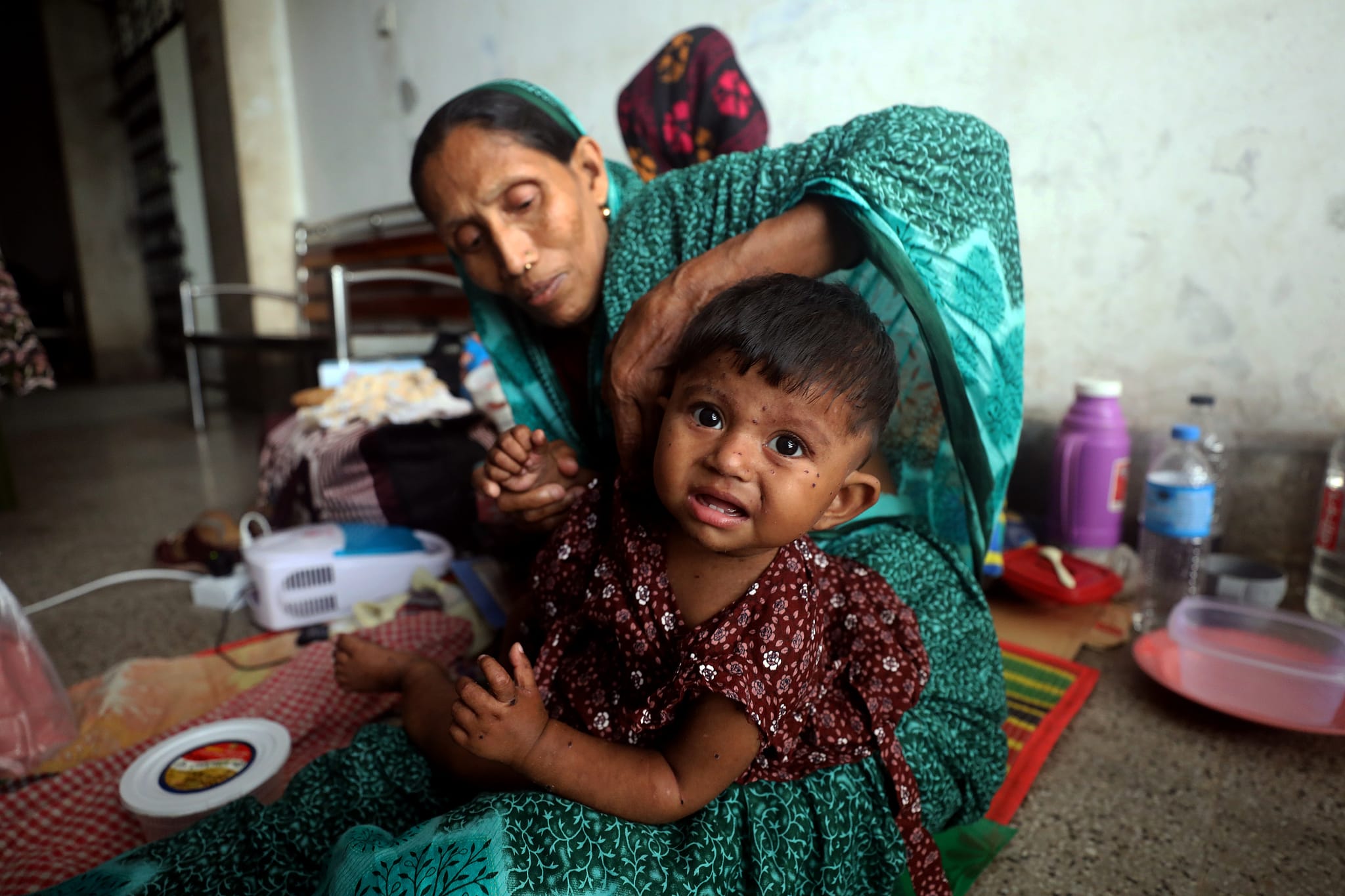 Reports indicate measles outbreaks in several districts across the country, with significant spread in at least seven districts. In the current month alone, 21 children have died from measles. The number of patients admitted with measles at the Infectious
