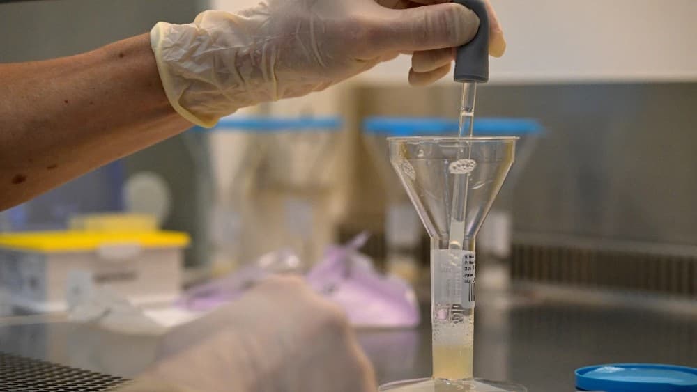 Doctors urge early PMOS diagnosis as Pakistan study reports 48.5% prevalence